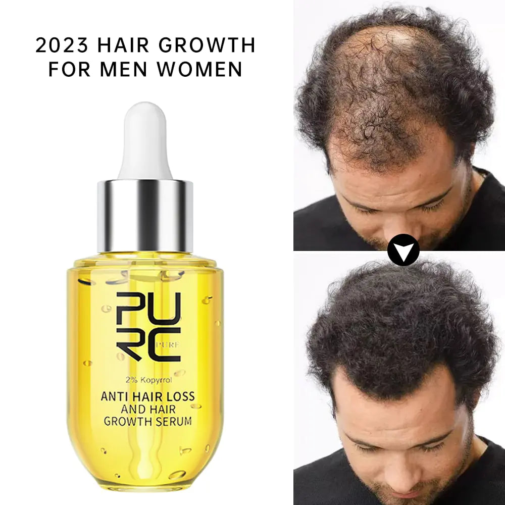 Fast Hair Growth Serum PURC Ginger Oil for Men & Women