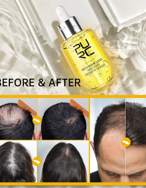 Load image into Gallery viewer, Fast Hair Growth Serum PURC Ginger Oil for Men &amp; Women
